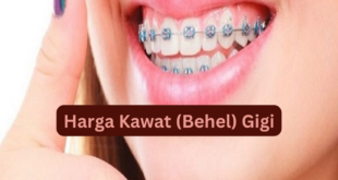 Harga Kawat (Behel) Gigi